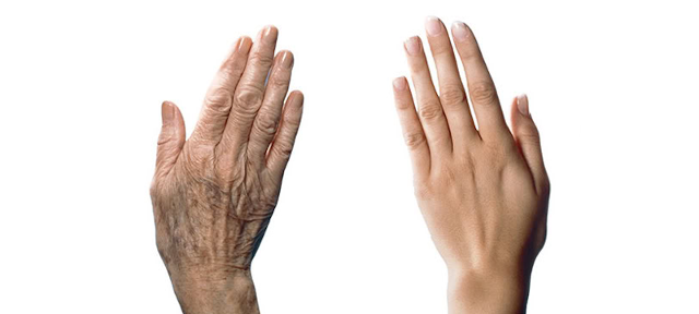 Il cosiddetto processo di "schelettrizzazione" è il principale indicatore del passare degli anni: le mani si presentano più rugose, più vuote; si assottigliano i tessuti molli e vengono in evidenza le vene e le strutture tendinee...