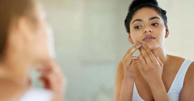 Non toccare i brufoli