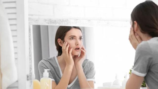 Cos'è nello specifico la maskne? Cos'è nello specifico la maskne?