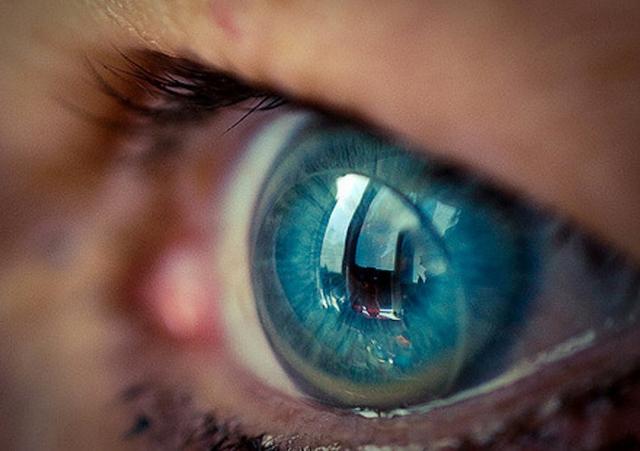 Come richiedere il "Bonus occhiali da vista e lenti a contatto"