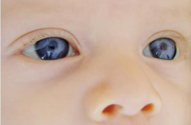Ci sono molti giocattoli che possono stimolare la visione dei bambini, migliorare la percezione visiva, l'acutezza e la capacità degli occhi di seguire persone e oggetti in movimento...